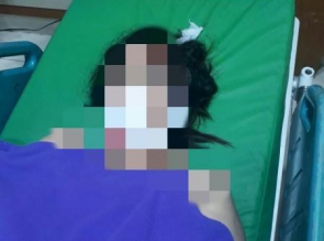 Kejahatan Jambret di Jalan Gunung Kidul Memakan Korban, Wanita Terseret hampir 12 Meter